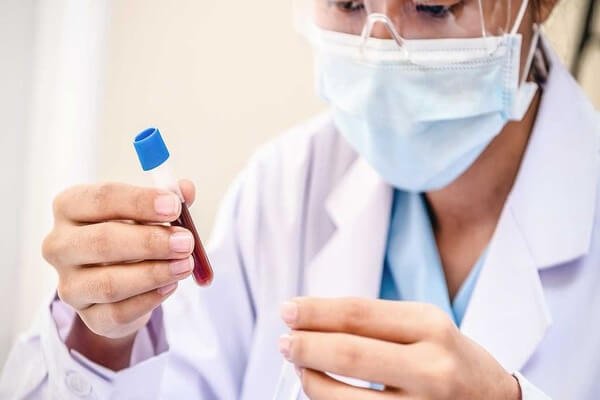 Xét nghiệm double test là gì xet-nghiem-double-test