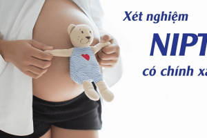 Kết quả xét nghiệm Nipt có đảm bảo chính xác không?